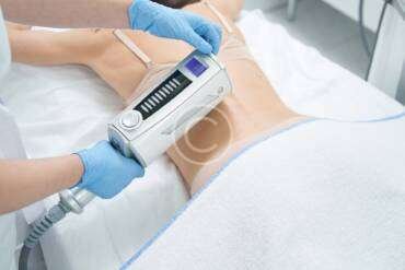 Non-surgical liposuction is the new weightloss trend post18-copyright