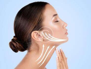 Why does a facelift start with your neck? post19-copyright