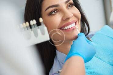 The color, shape and material options for your Hollywood smile post34-copyright