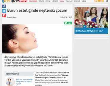 Burun Estetiğinde Neştersiz Çözüm burun-estetigi-960×750